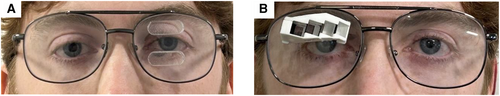Fresnel peripheral prism glasses and multi-periscopic prism glasses used in the clinical trial.