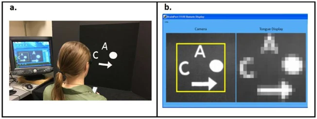 BrainPort training setup and camera-to-tongue stimulus display.
