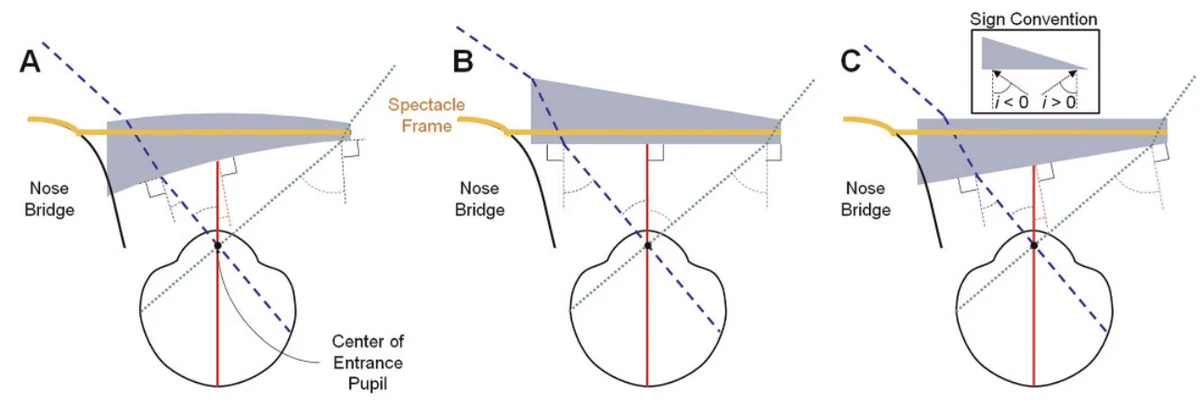 Optical diagrams showing field shift and apical scotoma with full-field prisms.