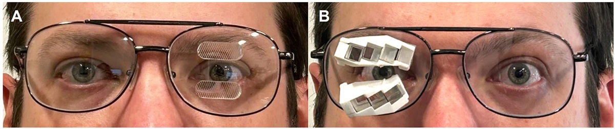 Fresnel and multi-periscopic peripheral prism glasses used in the pedestrian collision detection pilot study.